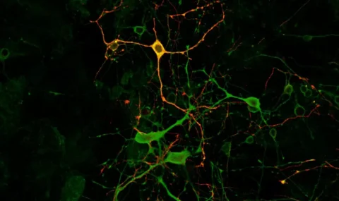 GABA and Dopamine immunostaining in crayfish eyetalk