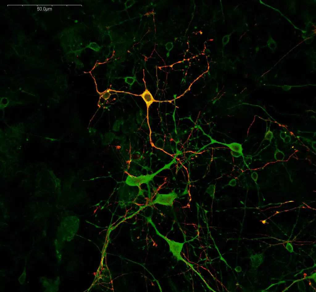 GABA and Dopamine immunostaining in crayfish eyetalk