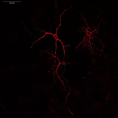 Staining of glutamatergic neurons in mouse primary cortical culture