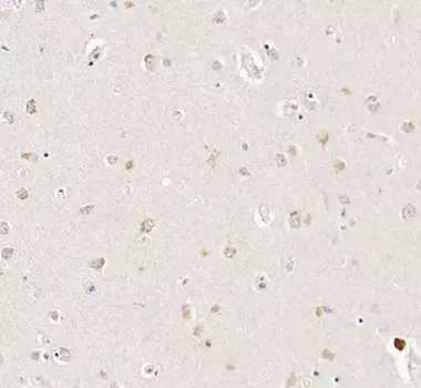 Anthranilic acid detection by IHC in human brain