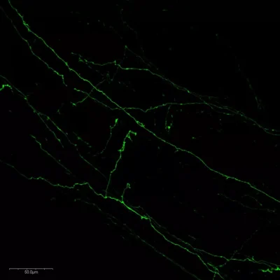 Noradrenaline fibers in the pons of mouse embryo.