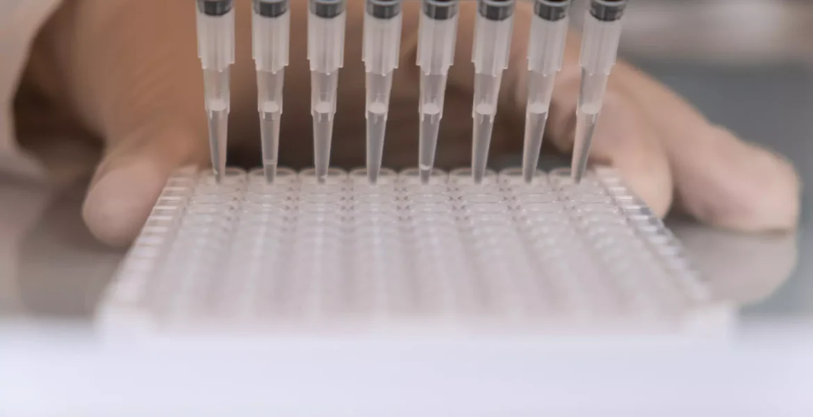 Highly Sensitive Citrulline ELISA kit validated for plasma samples