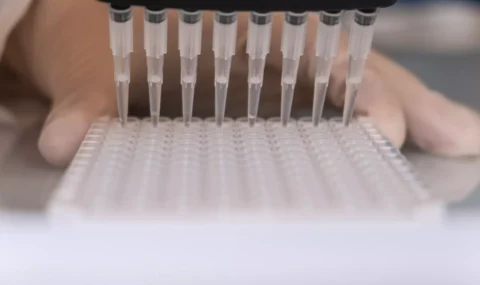 Highly Sensitive Citrulline ELISA kit validated for plasma samples
