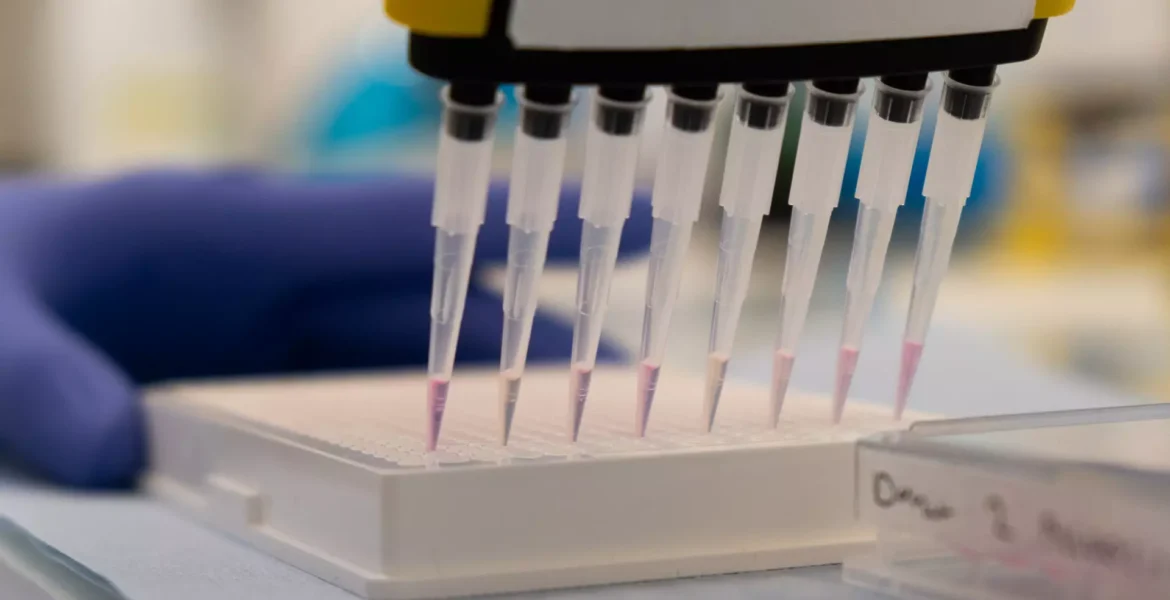 tryptophan kynurenine elisa