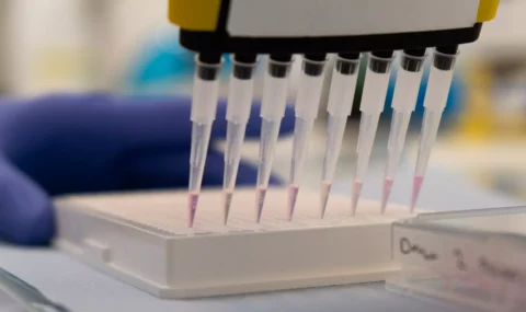 tryptophan kynurenine elisa