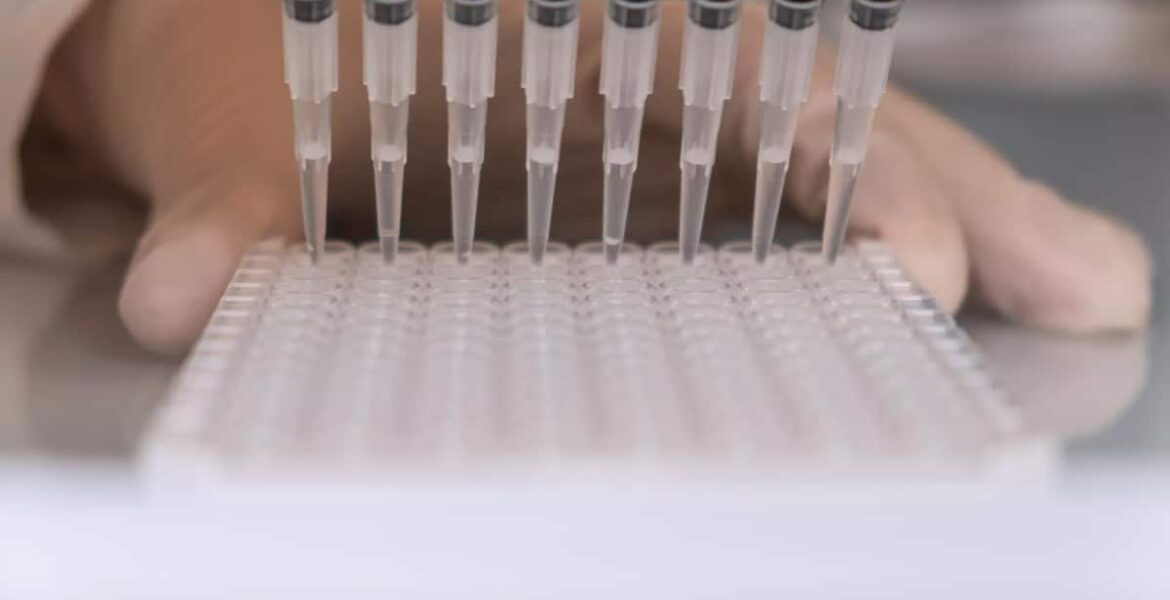 How to quantify dopamine: workflows, pitfalls, and validation checklist