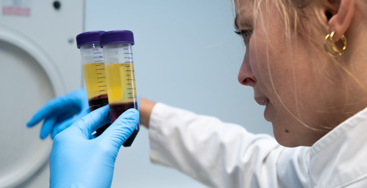 Arginine, Ornithine and Citrulline in Plasma ELISA Applications and Ratios