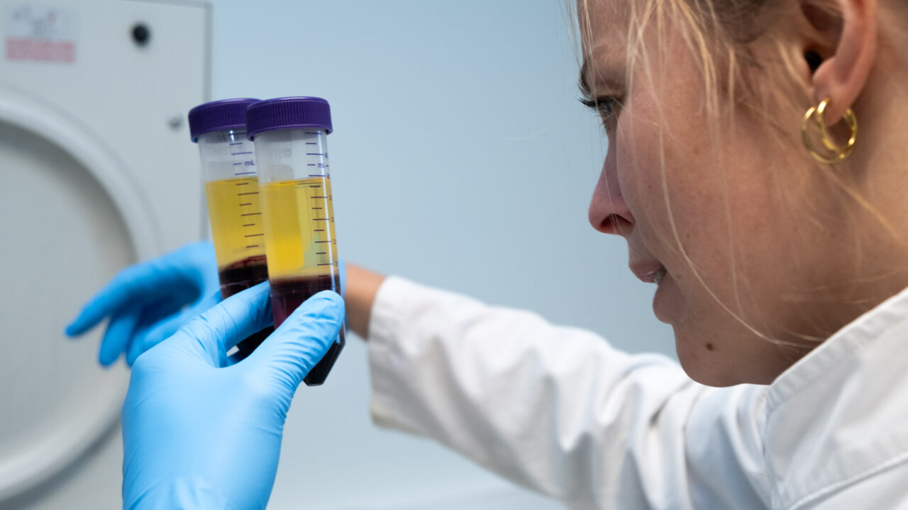 Arginine, Ornithine and Citrulline in Plasma ELISA Applications and Ratios