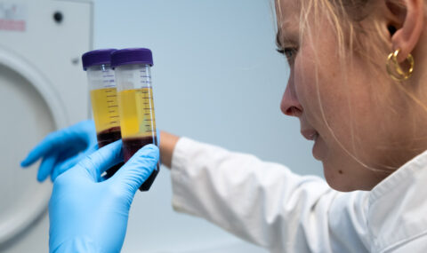 Arginine, Ornithine and Citrulline in Plasma ELISA Applications and Ratios