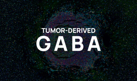 Tumor-derived GABA and resistance to immunotherapy in TLS-positive tumors
